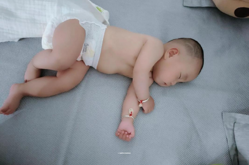 商丘宝宝头上长痱子